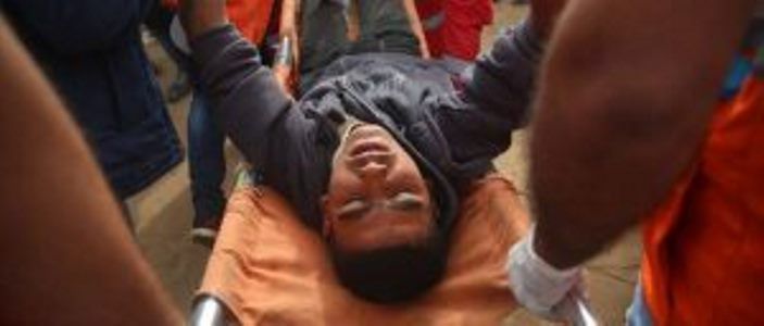 Amnistía afirma que devastadoras heridas de civiles de Gaza subrayan la necesidad urgente de un embargo de armas a Israel.