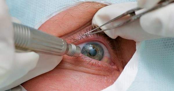 Servicio de Salud debe pagar 40 millones pesos a paciente que perdió la visión de su ojo izquierdo luego de ser operada 3 veces en el Hospital Regional de Concepción.