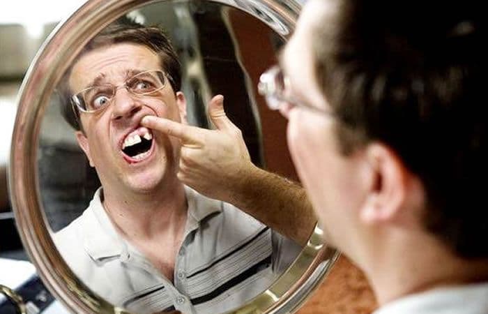 Hombre que golpeó a compañero de trabajo provocándole perdida de piezas dentales es condenado a tres años de prisión, por cuanto comporta la presencia de un estigma visible y permanente, resuelve el Tribunal Supremo de España.