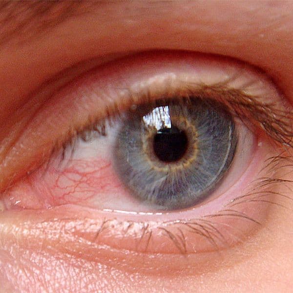 imagen: cliniteco.es