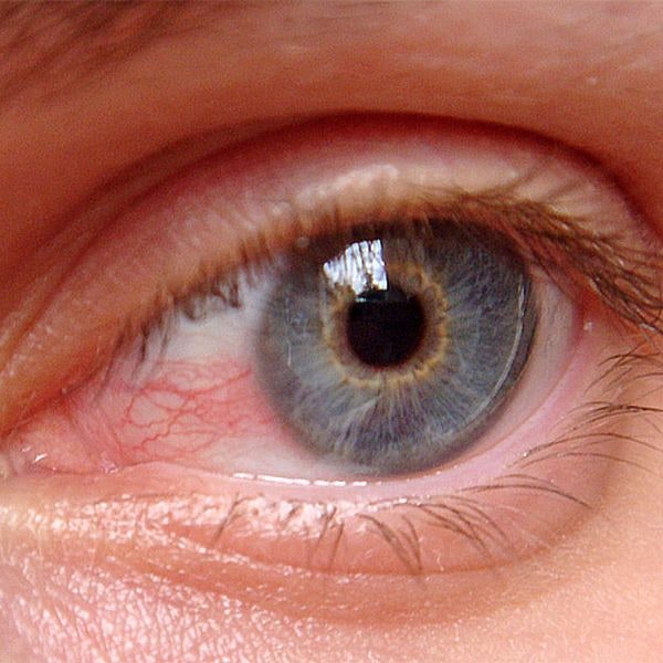 imagen: cliniteco.es