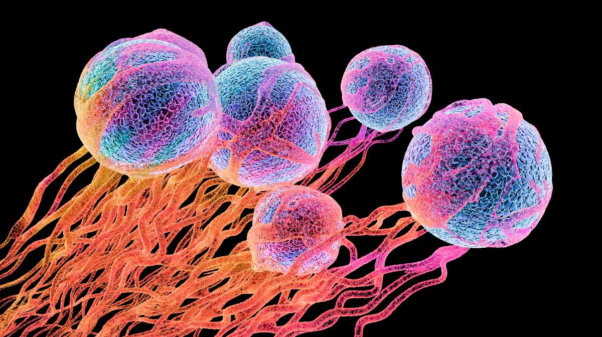 Incertidumbre sobre lo que hubiera pasado de haberse diagnosticado antes el tumor que provocó el cáncer terminal debe ser indemnizada, resuelve Tribunal español.