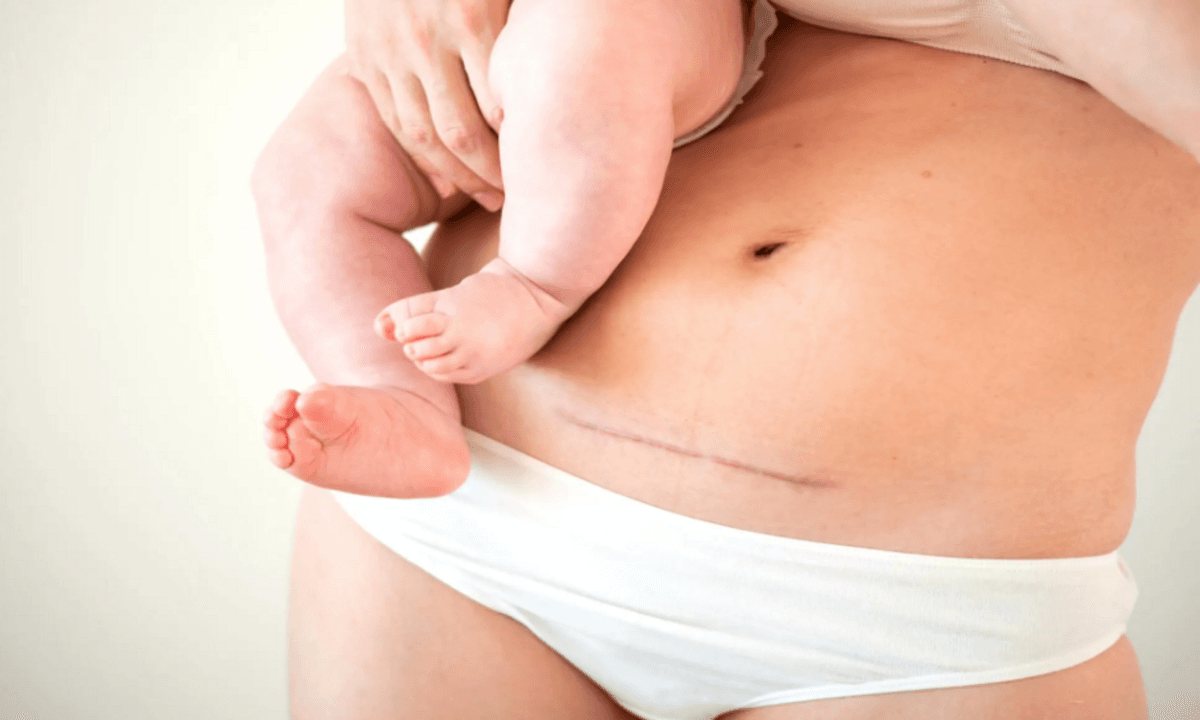 imagen: clinicaimar.com