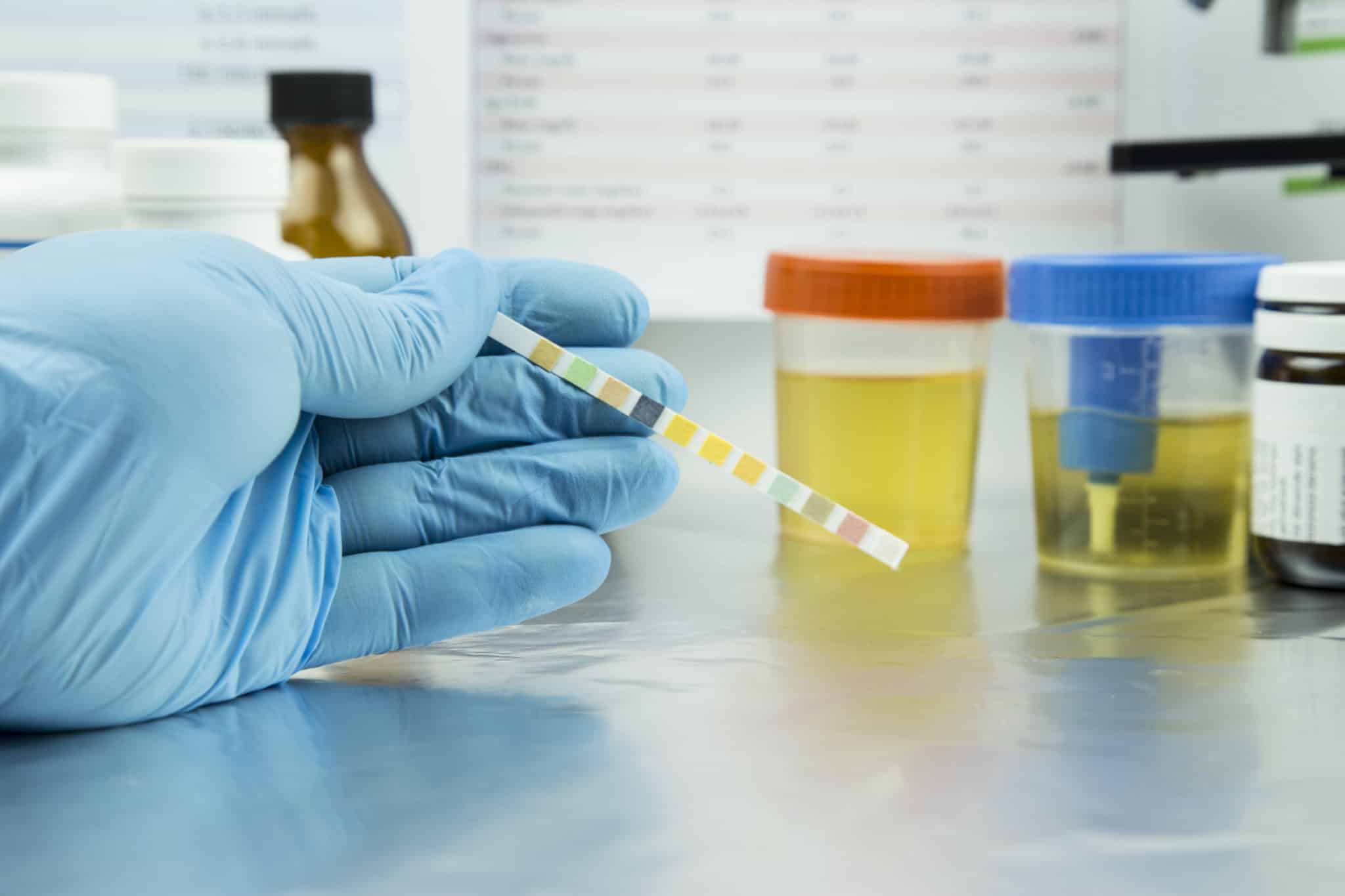 Contraloría instruye aplicación de test de drogas obligatorios a altas autoridades y fija criterios para su implementación